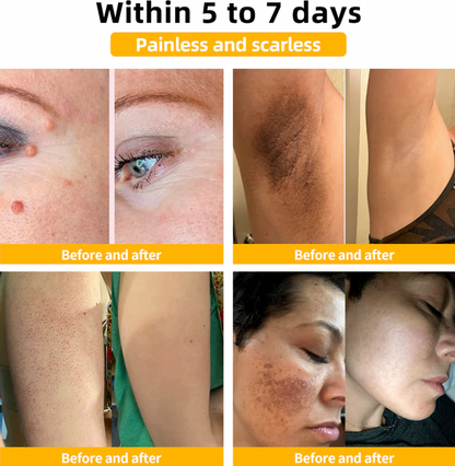 🐝 BEE VENOM ™ Natural Lifting Cream (Original)