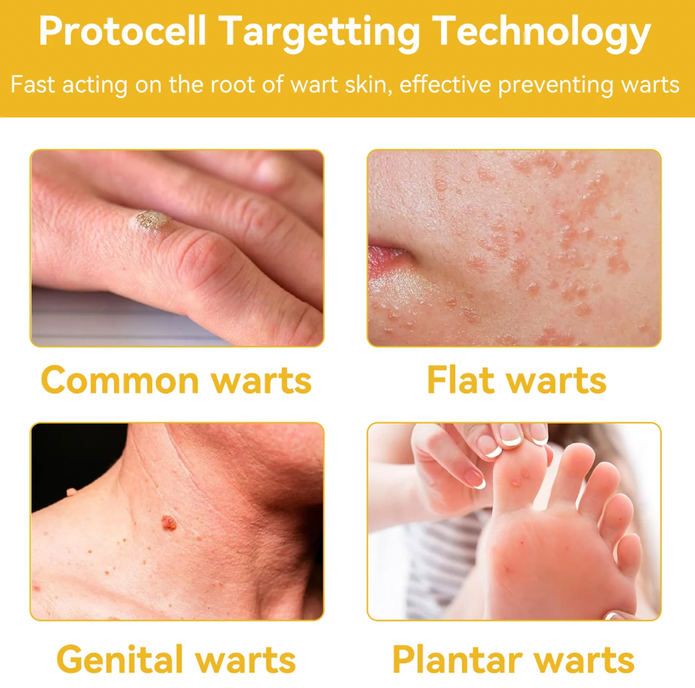 🐝 BEE VENOM ™ Natural Lifting Cream (Original)