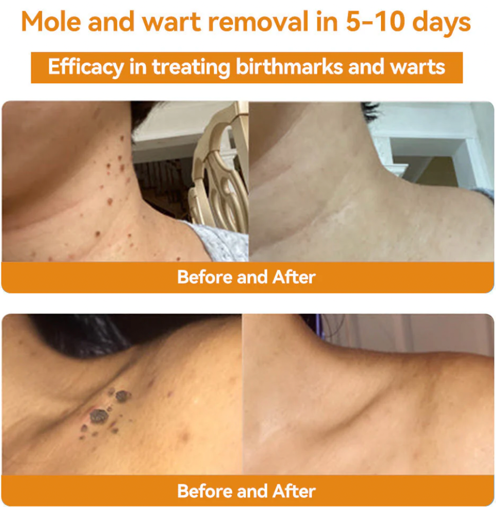 🐝 BEE VENOM ™ Natural Lifting Cream (Original)